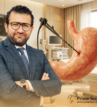 أفضل دكتور منظار معدة في مصر