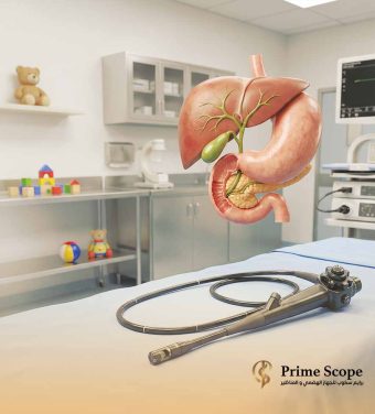 منظار القنوات المرارية ercp للاطفال